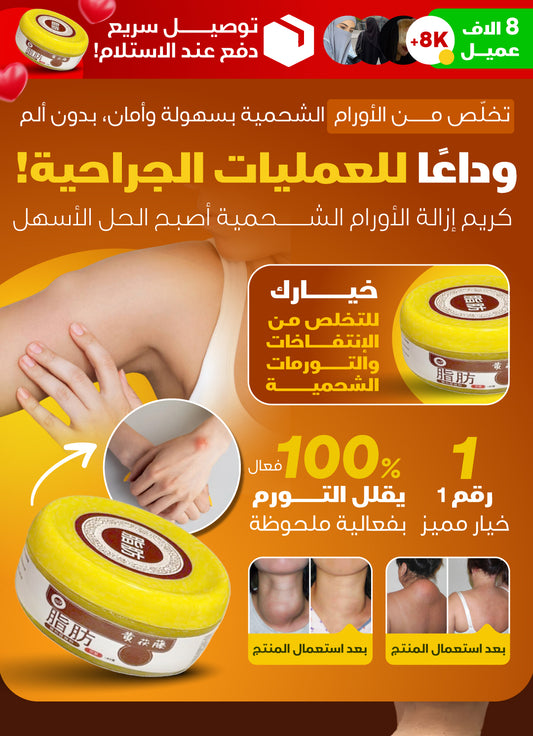 Lipoma